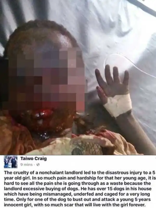 Oh No! 5-year-old Girl Brutally Attacked by One of Landlord